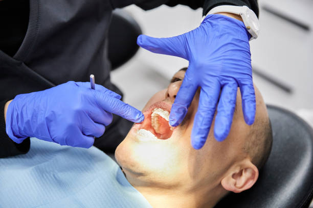 Best Knocked-Out Tooth (Avulsed Tooth) Treatment in Harwood Heights, IL